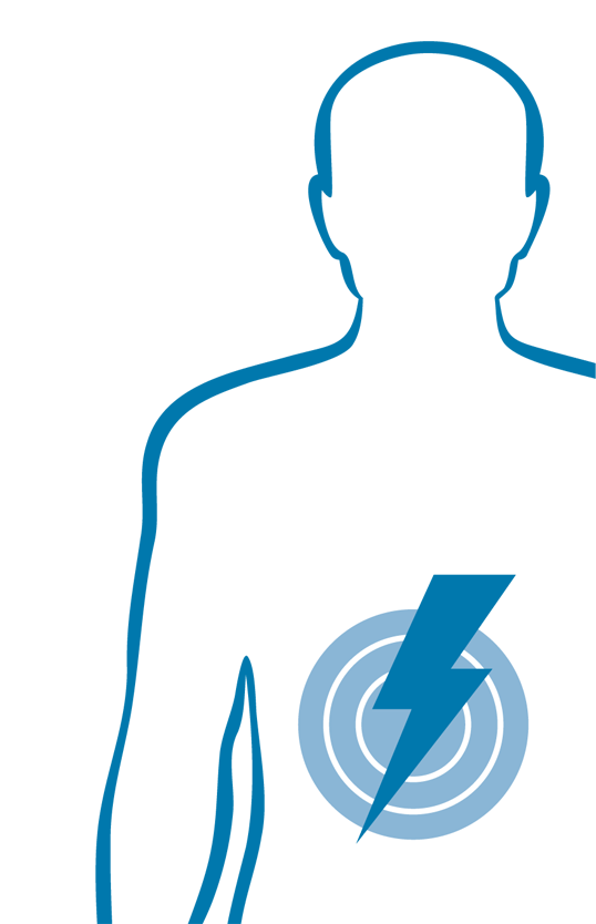 Akute Baucherkrankungen