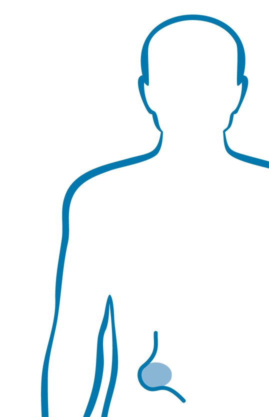 Bauchwand-/Leistenbruchchirurgie