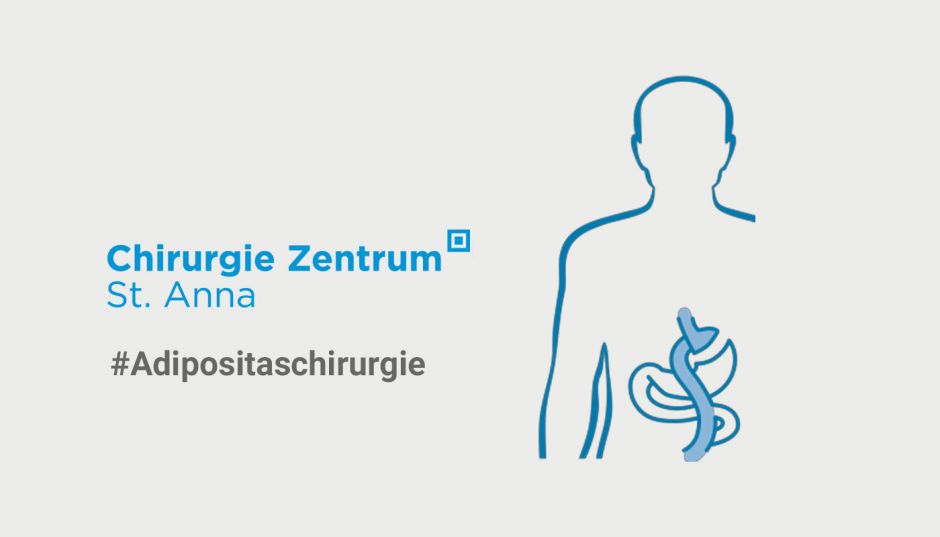 Warum Adipositas-OPs Leben retten können